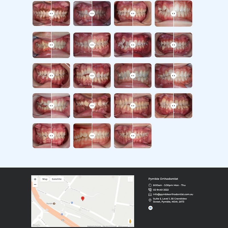 Pymble Orthodontist